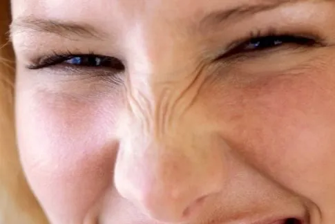 Botox για ρυτίδες έκφρασης μύτης από τον δερματολόγο Δρ. Νίκολαο Ζαπάρα Σέρρες
